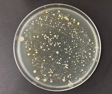 A petri dish containing first experiments: microbial samples from armpit, Biofilia, Aalto Univesity Helsinki, 2014.